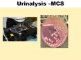 Urine Analysis, Urine MCS PowerPoint PPT Presentation