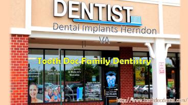 Dental implants Herndon VA
