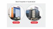 Best Hospitals in Hyderabad