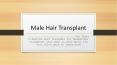 Male Hair Transplant PowerPoint PPT Presentation