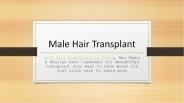 Male Hair Transplant