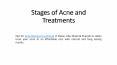 Stages of Acne and Treatments PowerPoint PPT Presentation