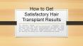 How to Get Satisfactory Hair Transplant Results PowerPoint PPT Presentation