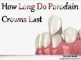 How Long Do Porcelain Crowns Last PowerPoint PPT Presentation