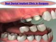 Top 5 Best Dental Implant Clinic in Gurgaon | Dental Implants in Gurgaon PowerPoint PPT Presentation