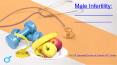 Male Infertility: Causes & treatment. What to eat to increase sperm quantity & quality? PowerPoint PPT Presentation
