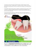 Advanced dental implant centre in banjara hills Hyderabad PowerPoint PPT Presentation
