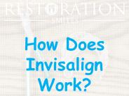 How Does Invisalign Work?