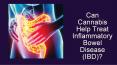 Can cannabis help treat inflammatory bowel disease (ibd) PowerPoint PPT Presentation