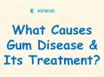 What Causes Gum Disease & Its Treatment? PowerPoint PPT Presentation