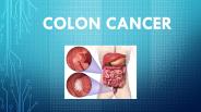 Colon Cancer || Indore