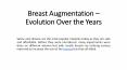 Breast Augmentation – Evolution Over the Years and Safest Technique Today PowerPoint PPT Presentation