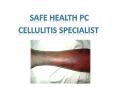 Cellulitis Specialist In Lansing and Mt. Pleasant PowerPoint PPT Presentation