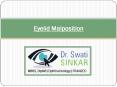 Eyelid Malposition & How to Treat It | Eye Specialist Adelaide PowerPoint PPT Presentation