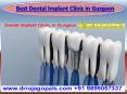 World Class Dental Implant Clinic in Gurgaon| Best Dental Implant Treatment in Gurgaon PowerPoint PPT Presentation
