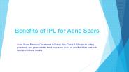 Benefits of IPL for Acne Scars