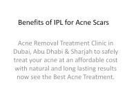 Benefits of IPL for Acne Scars
