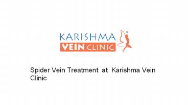 Spider  Vein Treatment :Know  What are casue and  treatmets