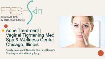 Acne Treatment | Vaginal Tightening Med Spa & Wellness Center Chicago, Illinois