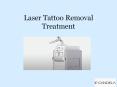 Laser Tattoo Removal Treatment PowerPoint PPT Presentation