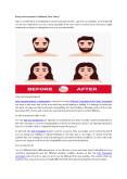Hair Transplant Cost In Hyderabad PowerPoint PPT Presentation