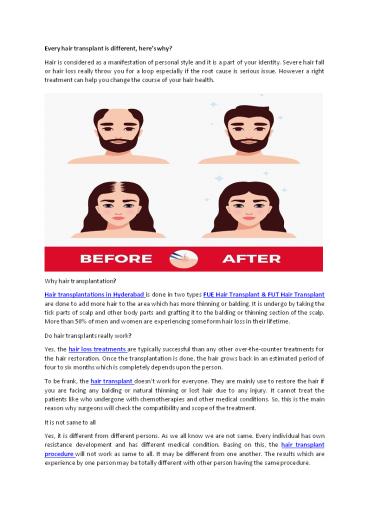 Hair Transplant Cost In Hyderabad (1)