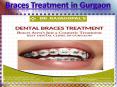 Best Braces Treatment in Gurgaon and Orthodontist in Gurgaon |  Dr. Raja Gopal PowerPoint PPT Presentation