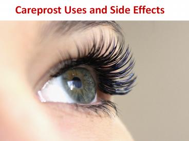 Careprost Uses and Side Effects