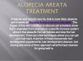 Alopecia Areata Islamabad PowerPoint PPT Presentation