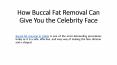 How Buccal Fat Removal Can Give You the Celebrity Face PowerPoint PPT Presentation