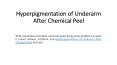 Hyperpigmentation of Underarm After Chemical Peel PowerPoint PPT Presentation