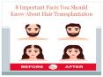 8 Important Facts You Should Know About Hair Transplantation PowerPoint PPT Presentation