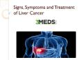 What is Liver Cancer ?Signs, Symptoms and Treatment PowerPoint PPT Presentation