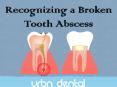 Recognizing a Broken Tooth Abscess PowerPoint PPT Presentation
