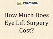 How Much Does Eye Lift Surgery Cost?