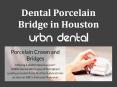 Dental Porcelain Bridge in Houston PowerPoint PPT Presentation