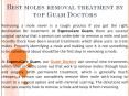 Best moles removal treatment by top Guam Doctors PowerPoint PPT Presentation