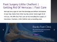 Foot Surgery Little Chalfont | Getting Rid Of Verrucas | Foot Care PowerPoint PPT Presentation