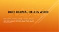 Does Dermal Fillers Work PowerPoint PPT Presentation