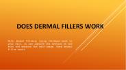 Does Dermal Fillers Work