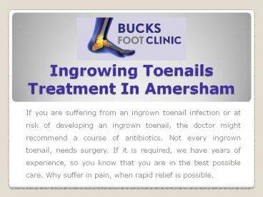 Ingrowing Toenails Treatment In Amersham | Foot Specialist