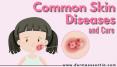 Common Skin Diseases and there Cure by Derma Essentia PowerPoint PPT Presentation