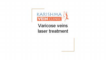 Get a varicose vein laser treatment