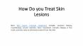 How Do You Treat Skin Lesions PowerPoint PPT Presentation