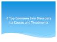 6 Top Common Skin Disorders, Its Causes and Treatment Options PowerPoint PPT Presentation