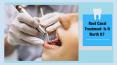 Root Canal Treatment: Is It Worth It? PowerPoint PPT Presentation