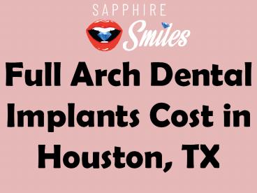 Full Arch Dental Implants Cost in Houston, TX