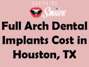 Full Arch Dental Implants Cost in Houston, TX
