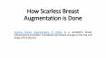 How Scarless Breast Augmentation is Done PowerPoint PPT Presentation