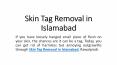 Skin Tag Removal in Islamabad PowerPoint PPT Presentation